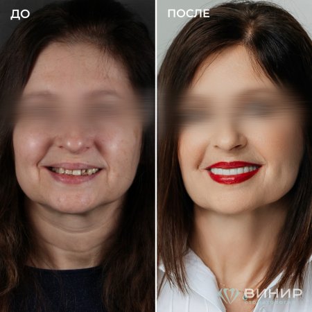 Бизнес-улыбка: инвестируйте в первое впечатление Бизнес-улыбка: инвестируйте в первое впечатление